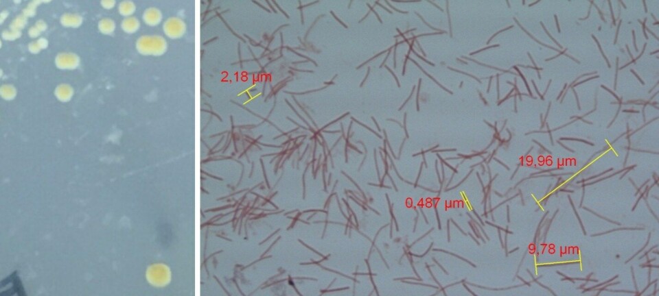 Fortalecer la inmunidad de mucosas: clave en la prevención de la tenacibaculosis