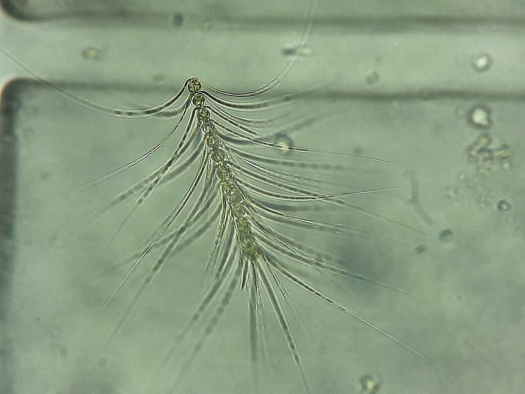 Chaetoceros cf. criophilus. Imagen: Fabiola Villanueva. Chaetoceros cf. criophilus. Imagen: Fabiola Villanueva.