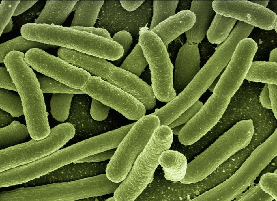 Imagen referencial bacteria. Fuente: Pixabay