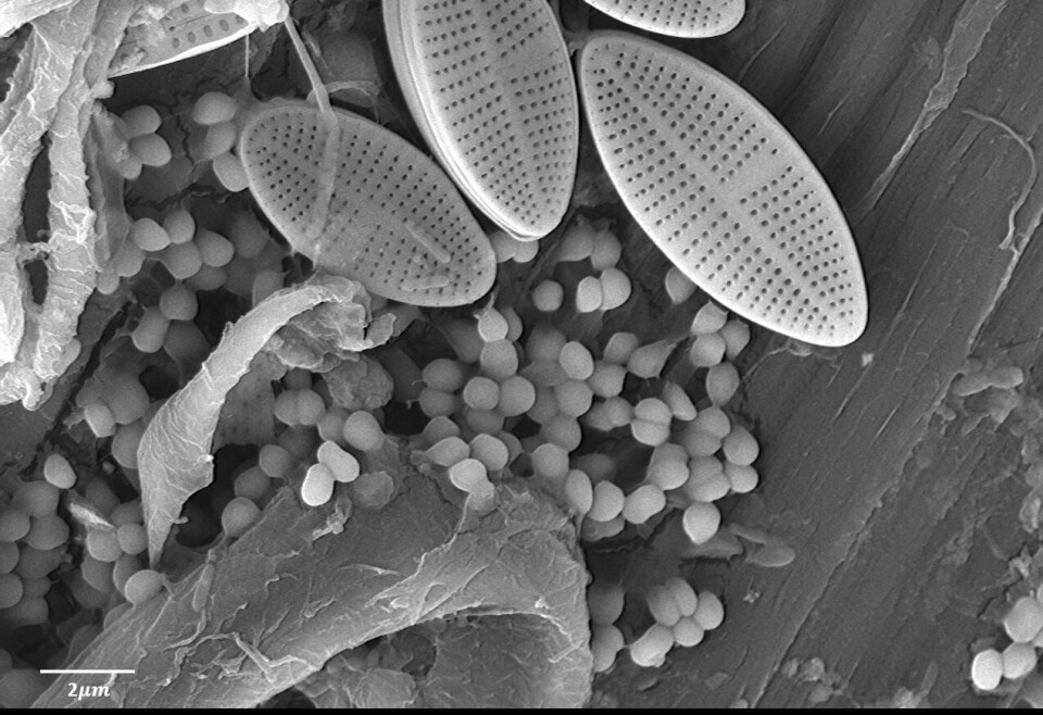 “Vida microbiana en microplásticos marinos”, ganadora de concurso FotoConciencia 2020 . Foto: UACh sede Puerto Montt.