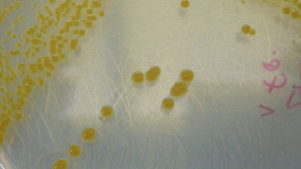 Cultivo de Flavobacterium. Foto: Ruben Avendaño.