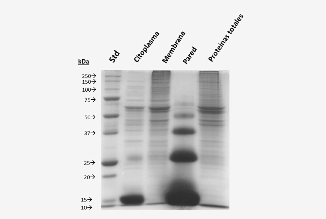 Perfil de proteínas de distintos componentes del aislado chileno R. salmoninarum H-2. Imagen: Dr. Ruben Avendaño.