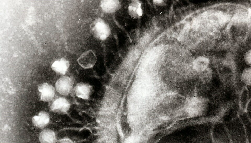 Bacteriófagos unidos a una bacteria. Fuente: Graham Beards, wikimedia commons.