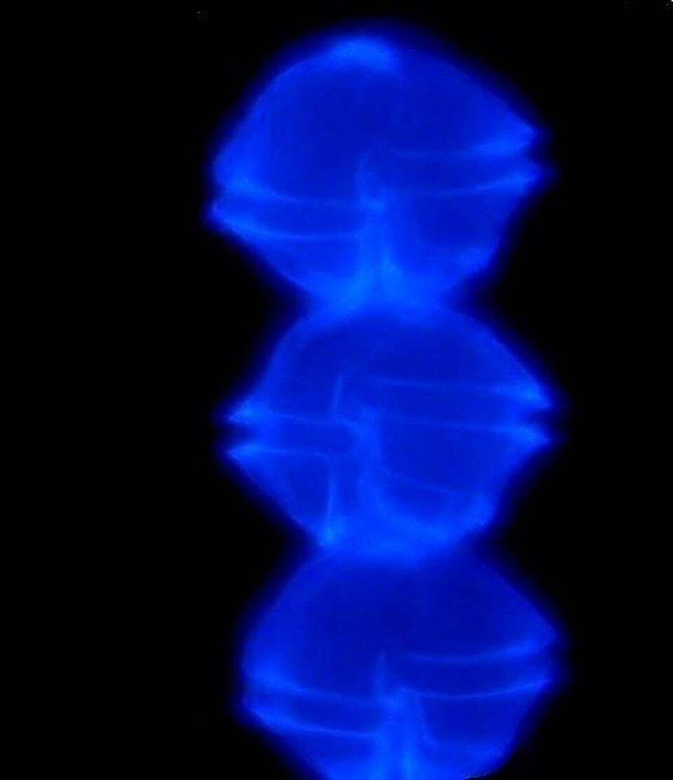 Alexandrium catenella con epifluorescencia final. Foto: Incar.