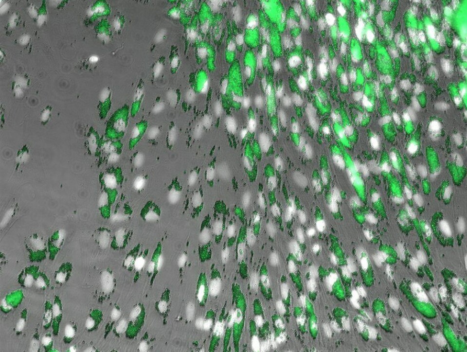 Después de siete días, se puede ver que los macrófagos absorben las pequeñas partículas de plástico. Foto: Anita Solhaug, Instituto Veterinario.