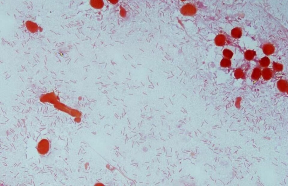 Tinción Gram en bazo de salmón Atlántico (100X). Abundante cantidad de Flavobacterias (Imagen: Laboratorio Antares S.A. – Alab).
