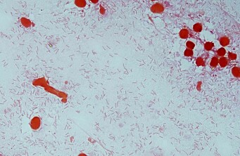 Estudio in vitro ayuda a esclarecer la patogenicidad de Flavobacterium psychrophilum