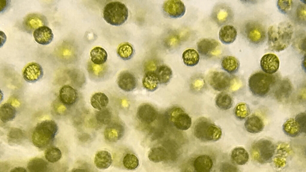 Microalga Lepidodinium Chlorophorum. Imagen: Claudia Uribe, North Patagonia. Microalga Lepidodinium Chlorophorum. Imagen: Claudia Uribe, North Patagonia.