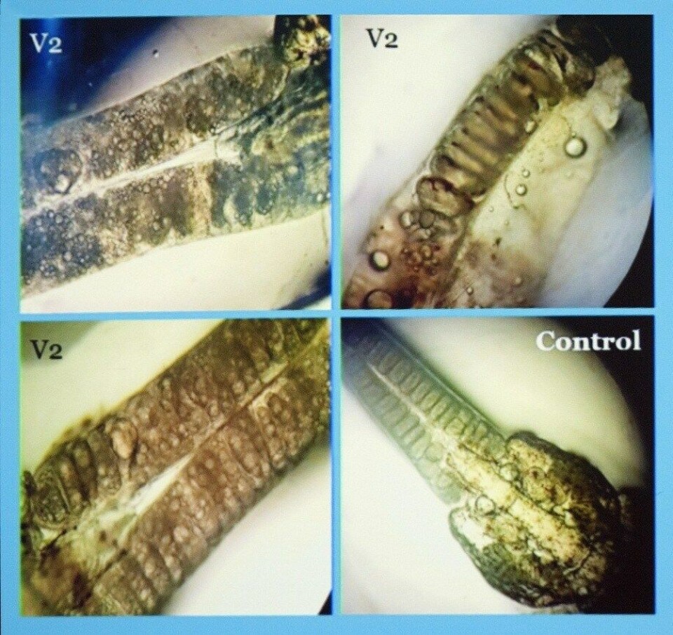 Huevos de hembras ovígeras que infectaron salmones vacunados con el prototipo V2. Fuente: Pedro Ilardi.