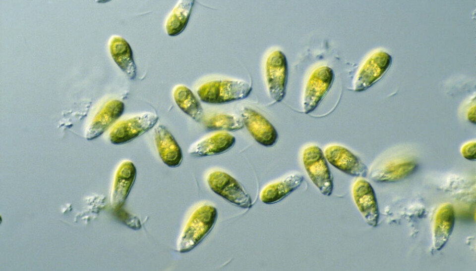 Imagen referencial de microalgas Dunaliella spp.