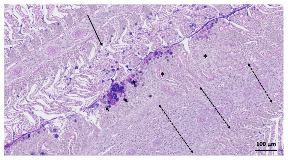Laminillas secundarias afectadas nivel leve a moderado (flecha larga) y con lesiones graves (asterisco). Las laminilla severamente afectada se fusionaron y se observa un aumento en el número de células mucosas en el margen periférico del epitelio branquial (flechas continuas). Las flechas discontinuas muestran una gran afluencia de células granulares eosinofílicas y leucocitos mononucleares. Fuente: Fridman y col., 2021.