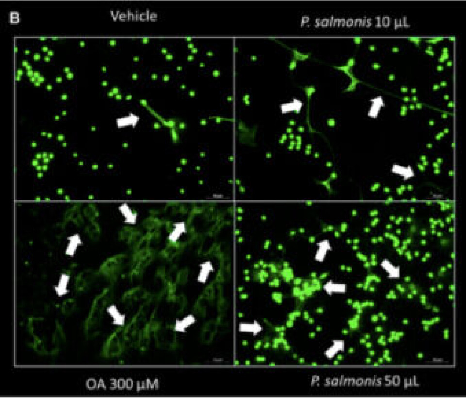El verde representa las estructuras del ADN de PMN y las flechas blancas indica estructuras similares a ET. Fuente: Alarcón y col., 2021.