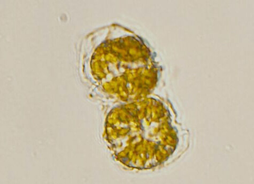 Alexandrium catenella, Protoceratium reticulatum, Dinophysis acuminata y Dinophysis acuta serían las microalgas detectadas por IFOP. Foto: Me.garneau.
