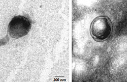 Vesículas producidas por Renibacterium podrían utilizarse para generar vacunas