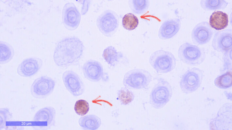 Células T CD4+ en riñón anterior marcadas con IHQ utilizando anticuerpos polilclonares específicos CD4 desarrollados por Pathovet. Image: Pathovet.