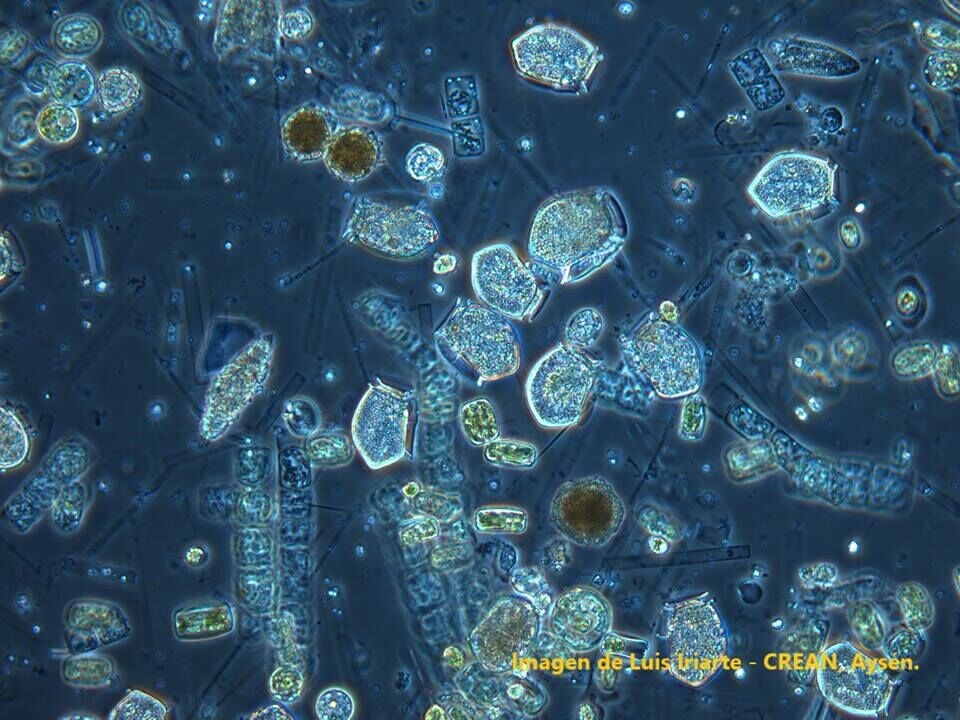 Imagen de Dinophysis acuta en canal Puyuhuapi (Aysén). Fuente: Luis Iriarte, Crean, Aysén.