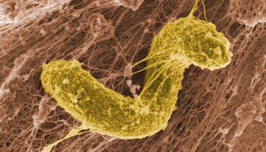 Bacteria reductora de sulfato (SRB) Desulfovibrio desulfuricans como parte de la matriz del biofilm. Bacteria reductora de sulfato (SRB) Desulfovibrio desulfuricans como parte de la matriz del biofilm.