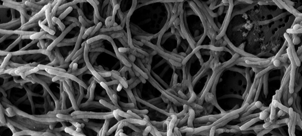 Publican genoma preliminar de especie de Tenacibaculum aislada en Chile