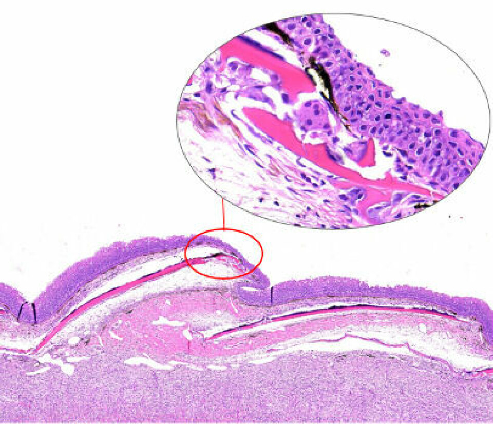Imagen 7. Sección histológica de piel (tinción H&E) con resorción de escamas por osteoclastos (O. kisutch).