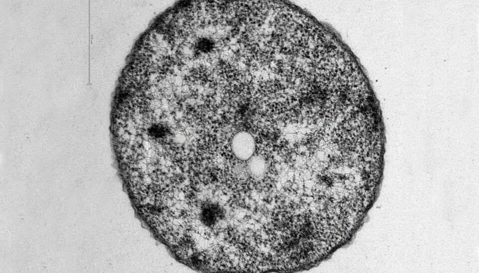 Microscopía electrónica de transmisión (STEM)
de P. salmonis 005 crecida en medio Austral SRS broth.