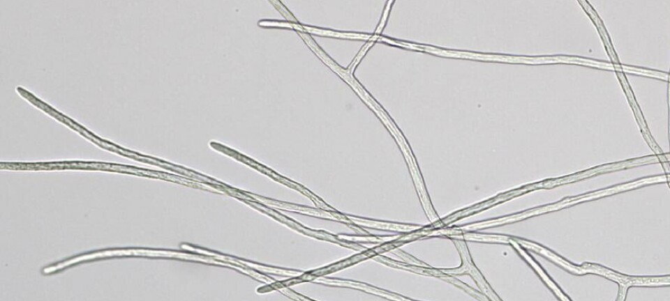 Desarrollan nuevo protocolo de qPCR diagnóstico de saprolegniasis