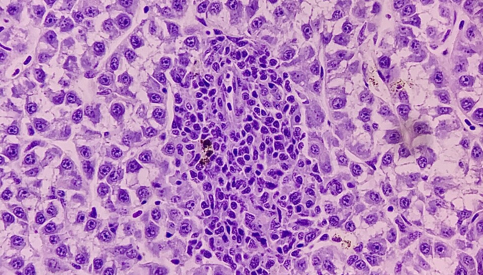 Infiltrado inflamatorio en tejido hético de salmón del Atlántico (H&E, 40X).