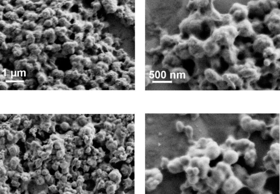 Microscopía electrónica de barrido por emisión de campo (FESEM) de IL1βIB producidas en matraces de agitación (arriba) y biorreactores (abajo).