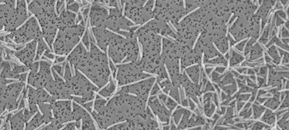Identifican nueva especie de Flavobacterium en pisciculturas de Chile