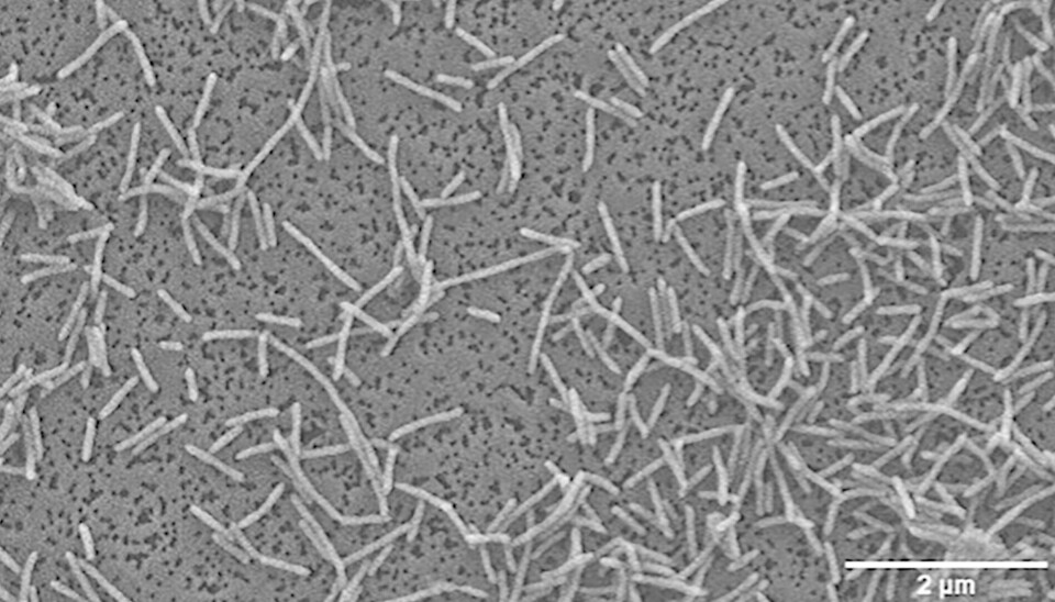 Microscopía electrónica de barrido de la cepa T-12 T de F. facile tras 48 h de incubación a 20°C en caldo TYES.