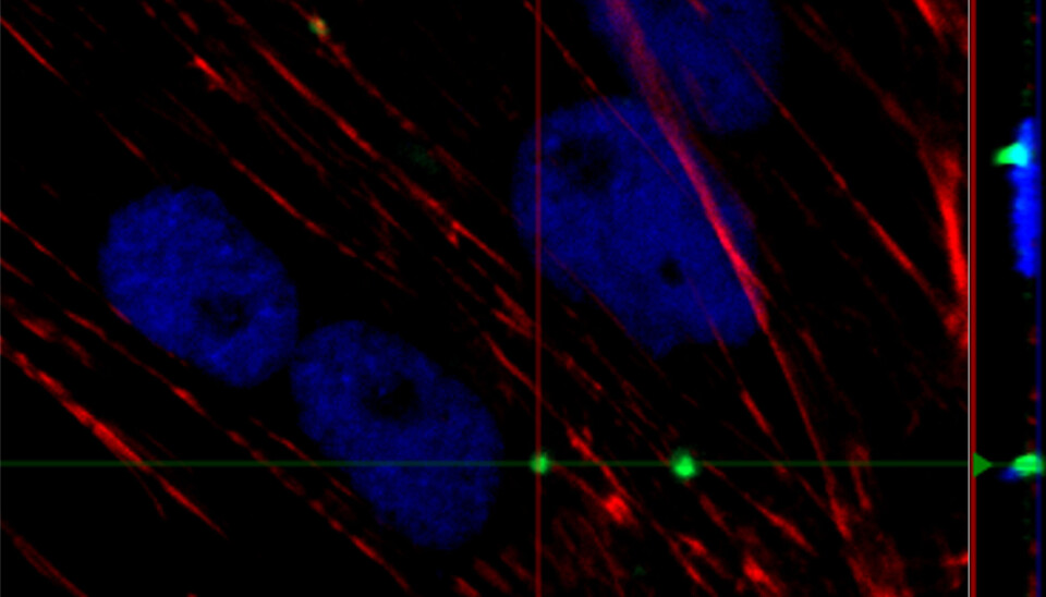 Célula tipo macrófago (SHK-1) con el nanosistema en su interior.