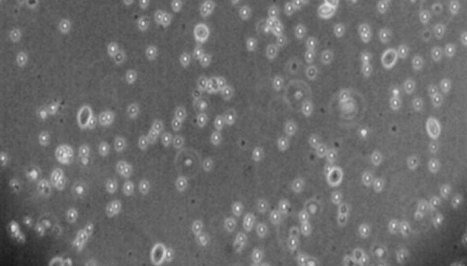 Eritrocitos infectados con PRV-3. Presentan características similares a la senescencia, incluyendo forma redondeada, tamaño celular reducido y depleción citoplasmática, lo que indica una respuesta a la infección viral.