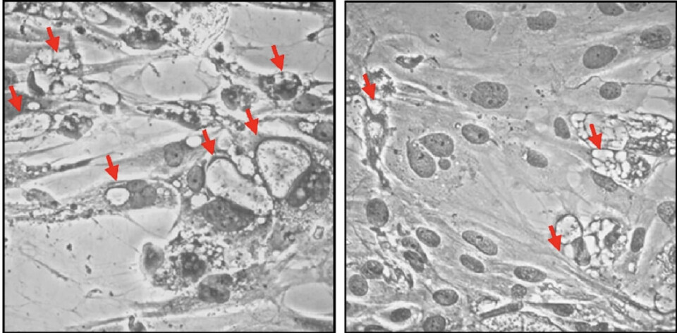 En la microfotografía se aprecian células SHK‑1 TK- WT (izquierda) y TF-KO (derecha expuestas a P. salmonis. Las flechas rojas indican vacuolas que contienen P. salmonis (PCV).