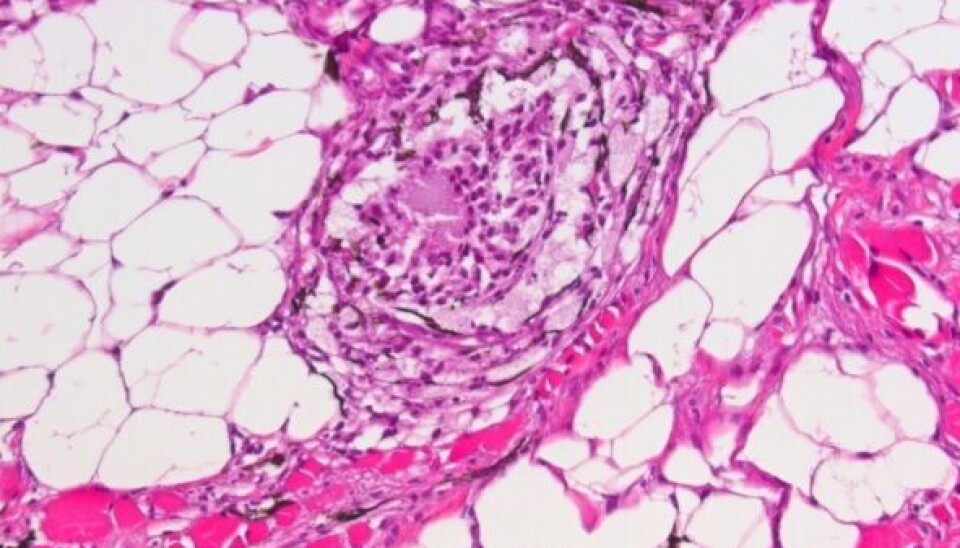 PRV virus.